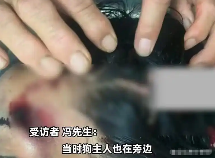 悲剧！河北女子骑车被狗撞倒身亡，主人为躲赔偿将狗打死 - php中文网