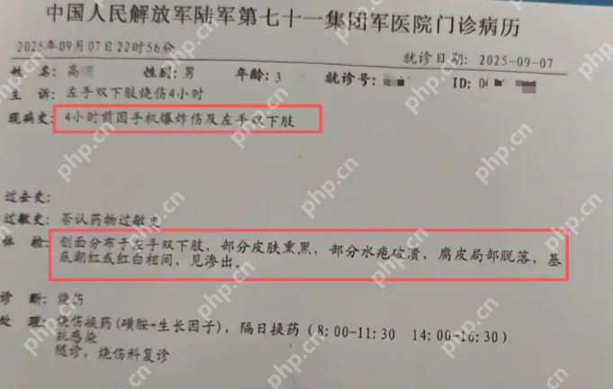小米13手机突发爆炸致3岁男童烧伤：安全警钟为谁而鸣？ - php中文网