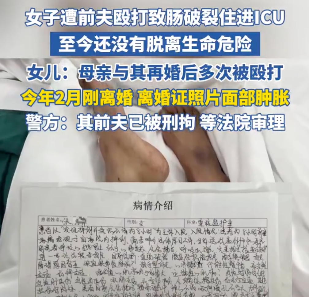 女子遭前夫殴打致肠破裂住进ICU 警方：嫌疑人已被刑拘 - php中文网