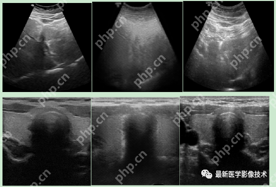 USenhance2023——2023 年超声图像增强挑战赛