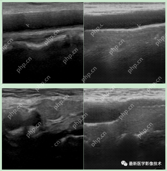 USenhance2023——2023 年超声图像增强挑战赛